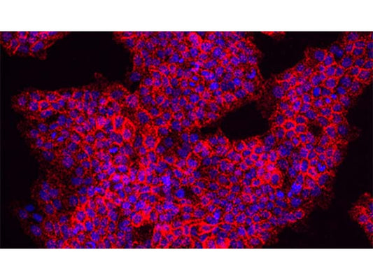 Proximity Ligation Assay (PLA) Combined with Post-Translational Modifications (PTMs) Studies: A Novel Approach for Protein Research.