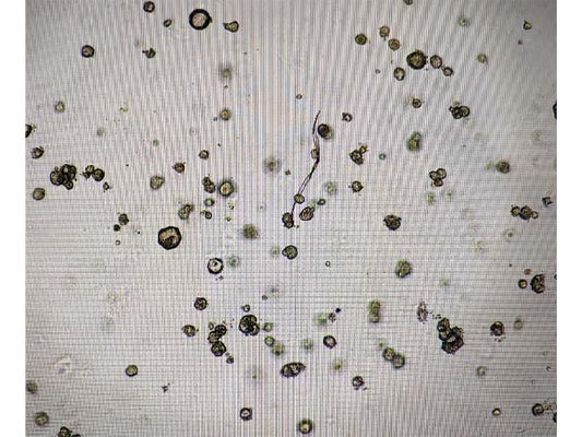 Why are organoids not long after passage?
