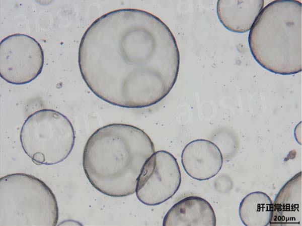 Select highly active factors to cultivate larger organoids