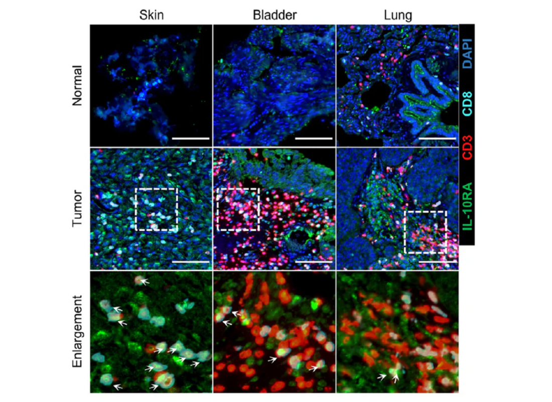 The "Invisible Hero" Behind Groundbreaking Bacterial Immunotherapy: Absin Products Empower IL-10R Hysteresis Research on Cell