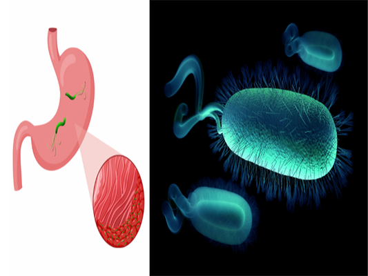A New Boost for Immunohistochemistry: The Launch of Recombinant Rabbit Monoclonal Antibodies Against Helicobacter pylori (Hp)!