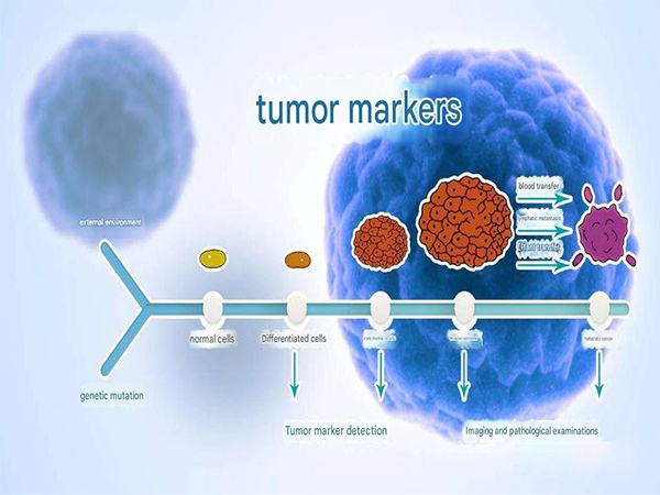 Immunohistochemical (IHC) Tumor Markers | Common Breast Cancer Diagnostics