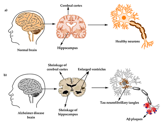 Innovative Approaches to Building and Validating Alzheimer's Disease Models