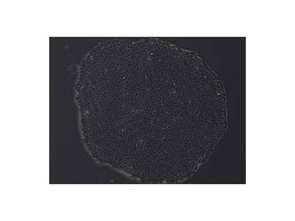 Pluripotent Stem Cell-Derived Neural Stem Cell Differentiation: A Practical Guide