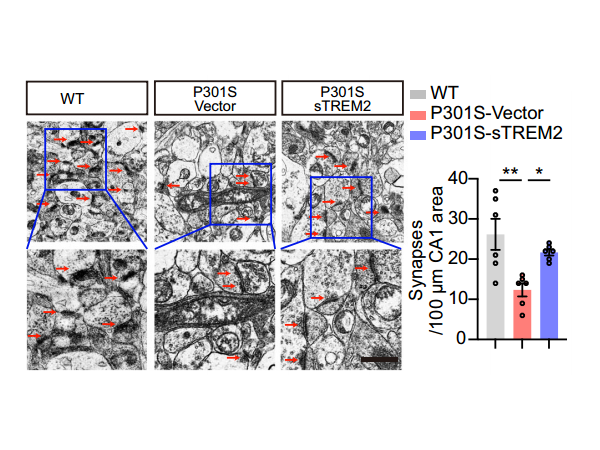 Literature Review: sTREM2 for AD Tau Phosphorylation and Cognitive Deficits