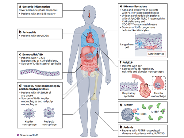 Revitalizing Insights: New Discoveries in the Biology and Clinical Applications of IL-18