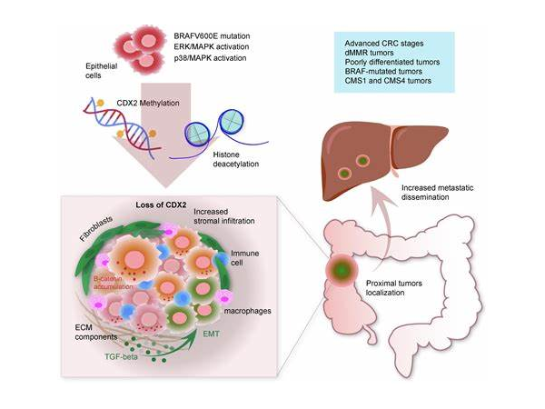 CDX2: An Underestimated Key Factor in the Diagnosis and Treatment of Colorectal Cancer