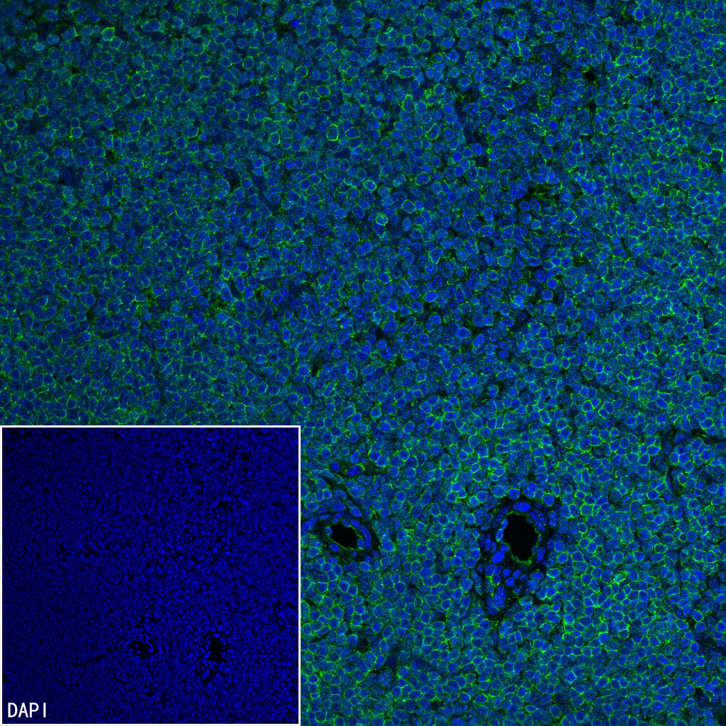 Moesin Rabbit Polyclonal Antibody