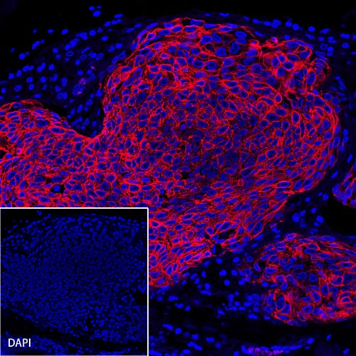 CK-Pan Recombinant Rabbit mAb (Alexa Fluor® 594 Conjugate) (S-P001)