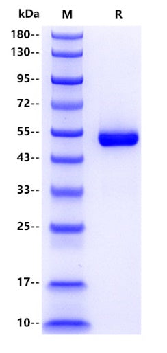 Human Urokinase Protein, His tag