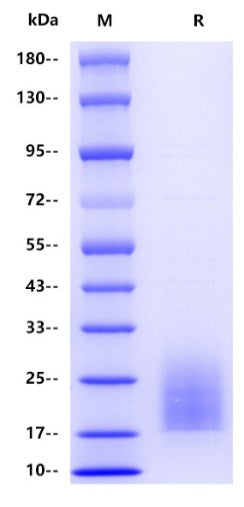 Human CD3 delta Protein, His Tag