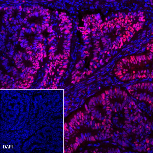 Progesterone Receptor Recombinant Rabbit mAb (Alexa Fluor® 555 Conjugate) (SDT-R123)
