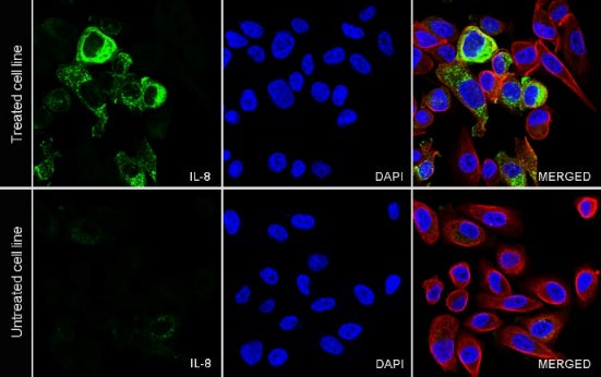 IL-8 Recombinant Rabbit mAb (S-162-38)