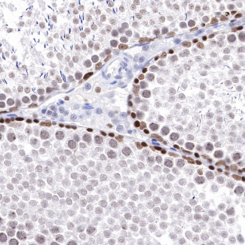 PARP1 Recombinant Rabbit mAb (S-220-179)