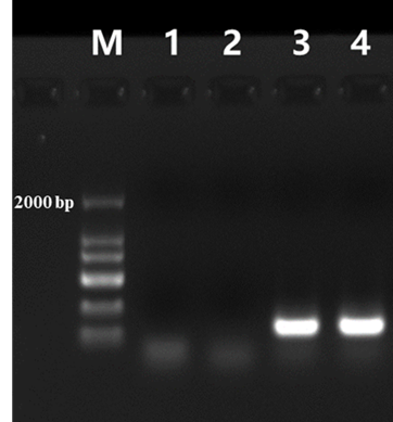 M-MLV (H-) Reverse Transcriptase