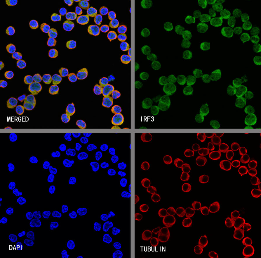 IRF3 Recombinant Rabbit mAb (S-4395)