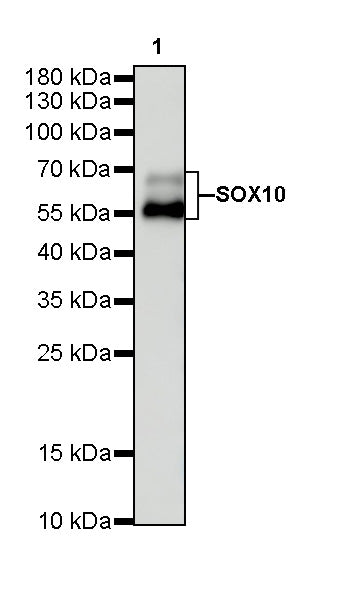 SOX10 Recombinant Rabbit mAb (SDT-136-59)