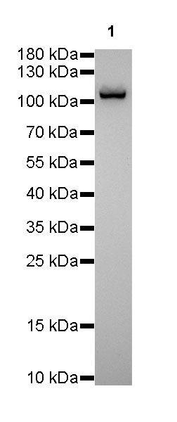 α-Actinin-1 Recombinant Rabbit mAb (SDT-311-20)