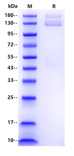 Human L1CAM/CD171 Protein, His tag