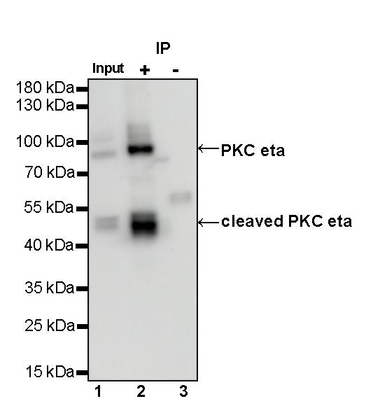 PKC eta Recombinant Rabbit mAb (S-1053-35)