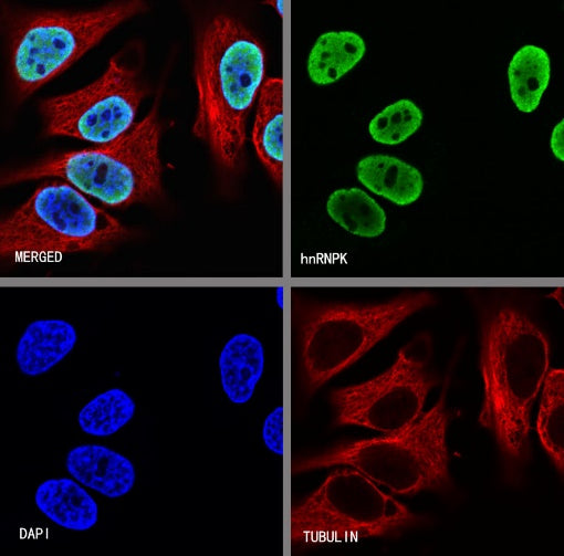 hnRNPK Recombinant Rabbit mAb (S-1645-45)