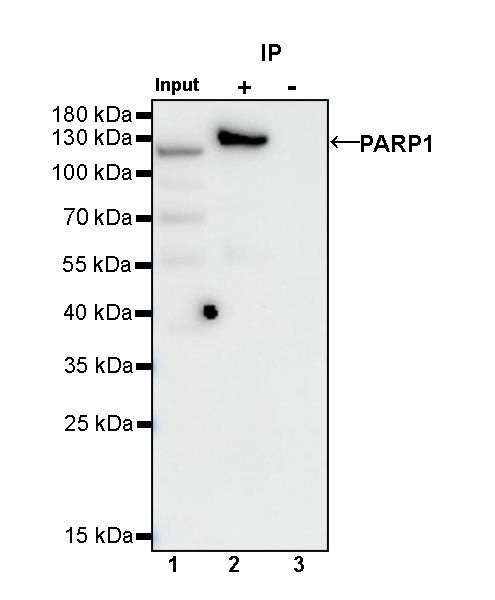 PARP1 Recombinant Rabbit mAb (S-R299)