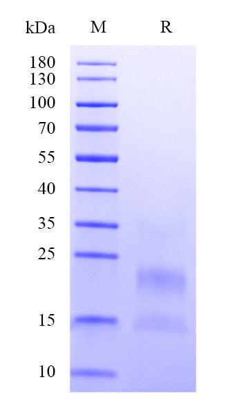 Human HE4 Protein, His Tag