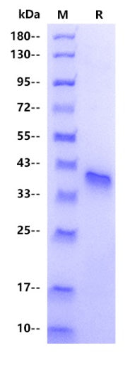 IGFBP5 His Tag Protein, Human