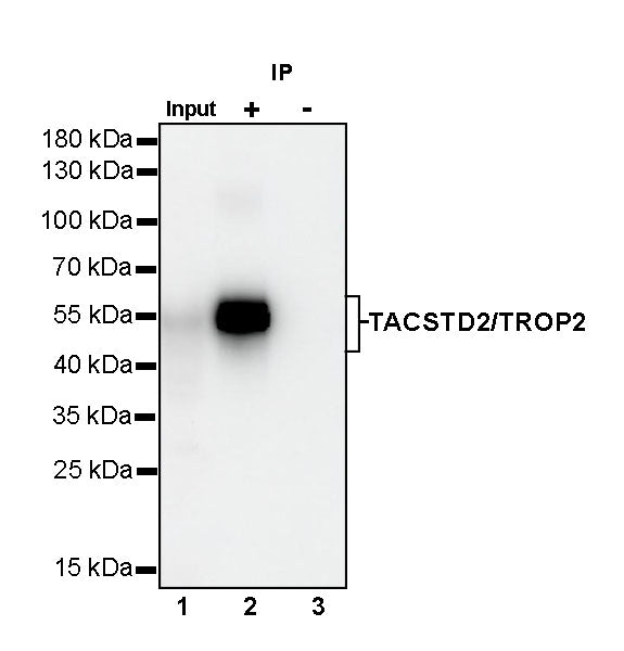 TACSTD2/TROP2 Recombinant Rabbit mAb (S-R238)