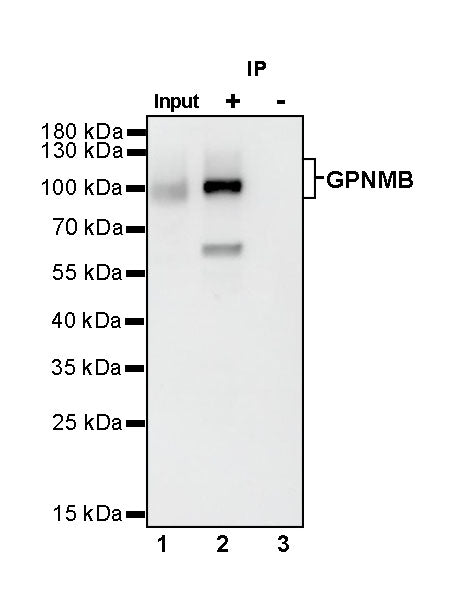 GPNMB Recombinant Rabbit mAb (S-R241)