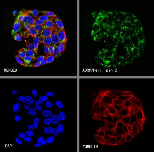 ADRP/Perilipin-2 Recombinant Rabbit mAb (S-2210-3)