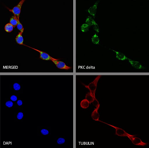 PKC delta Recombinant Rabbit mAb (S-2563-26)
