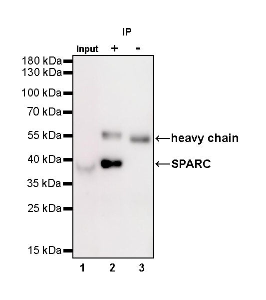 SPARC Recombinant Rabbit mAb (SDT-R136)