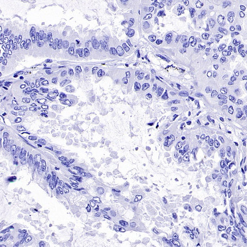 SEZ6 Recombinant Rabbit mAb (SDT-2097-737)