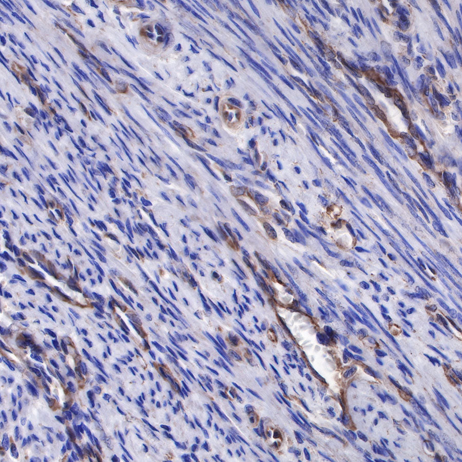 sFlt-1/VEGF Receptor 1 Recombinant Rabbit mAb (SDT-233-29)