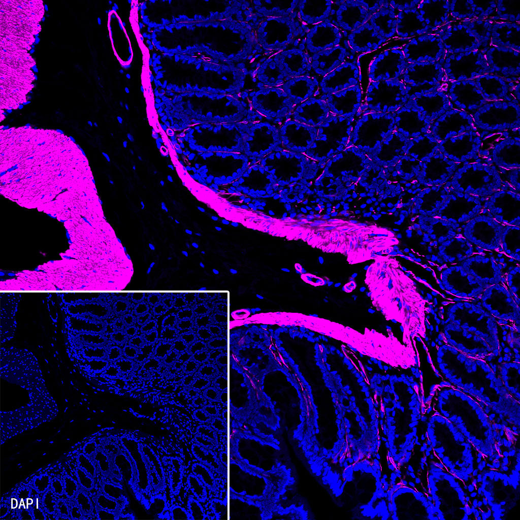 alpha smooth muscle Actin Recombinant Rabbit mAb (Alexa Fluor® 647 Conjugate) (SDT-132-63)