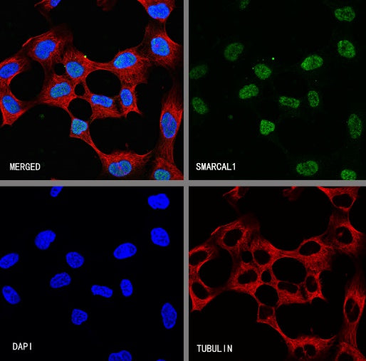 SMARCAL1 Recombinant Rabbit mAb (S-2110-328)