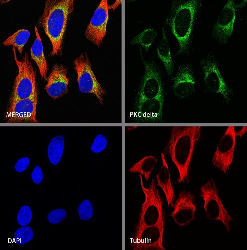 PKC delta Recombinant Rabbit mAb (S-1667-50)