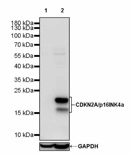 CDKN2A/p16INK4a Recombinant Rabbit mAb (S-2536-38)