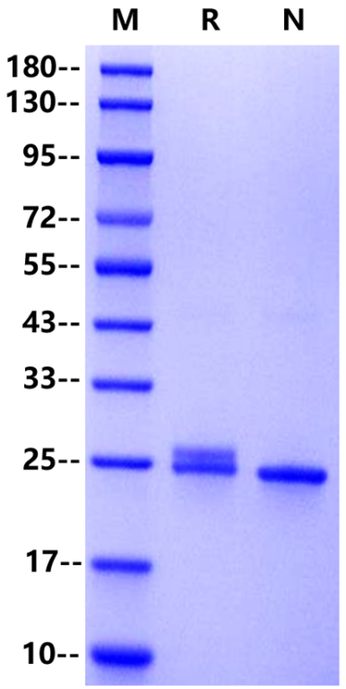 C-Reactive Protein(CRP) His Tag Protein, Human