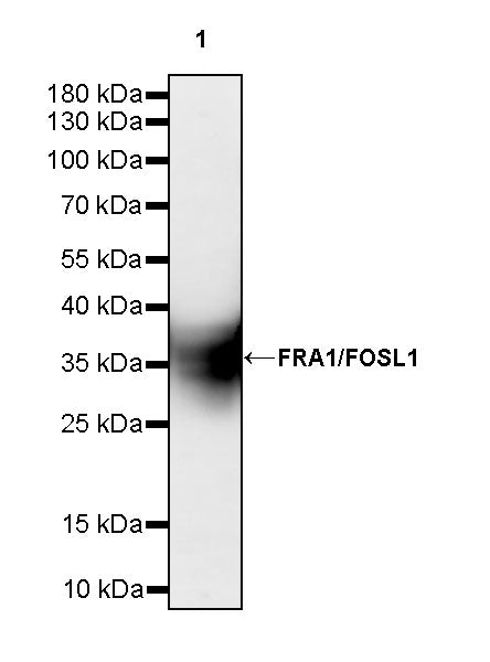 FRA1/FOSL1 Recombinant Rabbit mAb (S-3772-68)