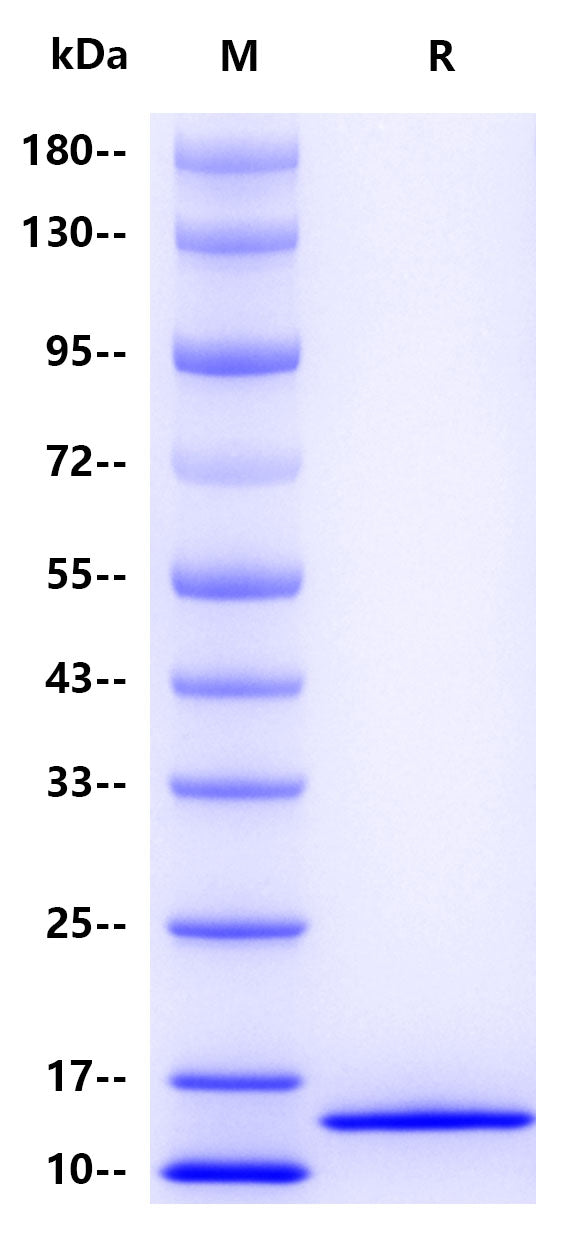 Human immunoglobulin Kappa constant , His tag