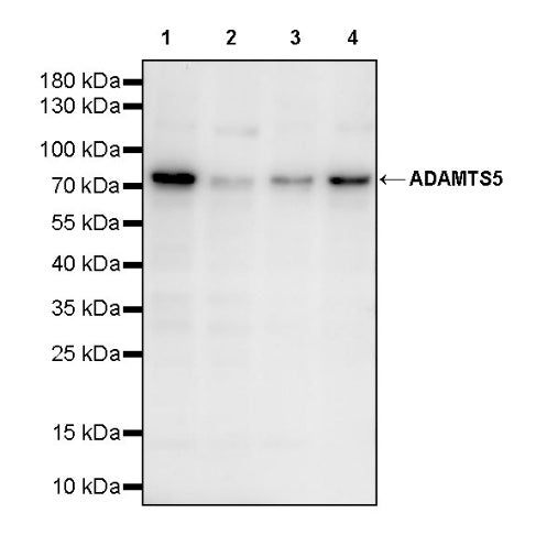 ADAMTS5 Recombinant Rabbit mAb (S-2315-138)