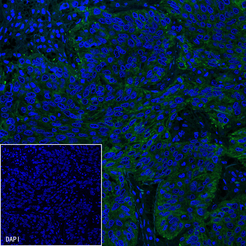 PD-L1 Recombinant Rabbit mAb (SDT-R017)