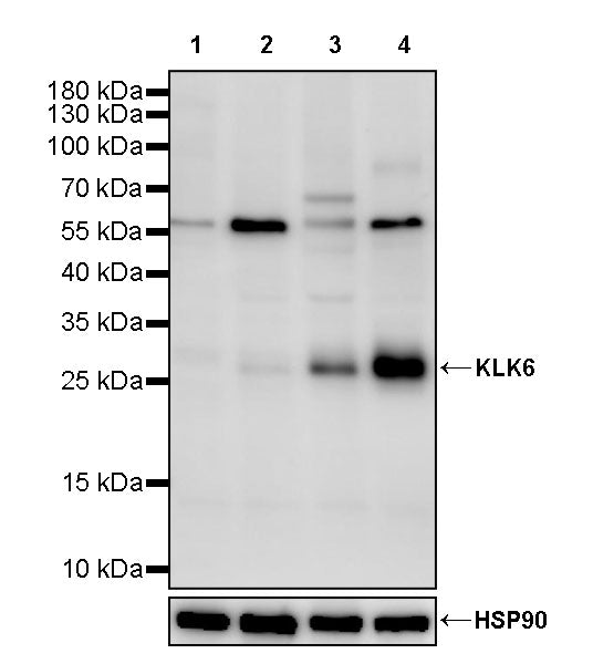 KLK6 Recombinant Rabbit mAb (S-2492-111)