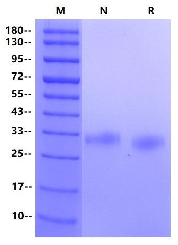Fc γ RIIa/CD32a(R167) His tag Protein, Human
