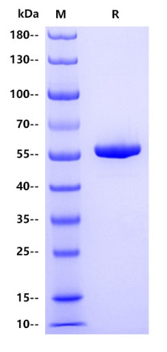 Human IFIT1 Protein, His tag