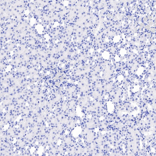Neurofilament L Recombinant Rabbit mAb (S-635-214)
