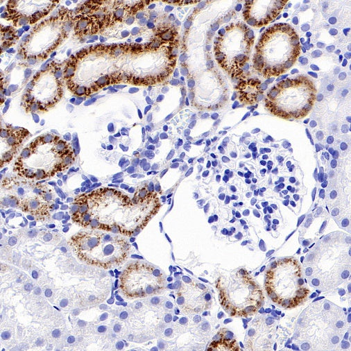 LAMP1 Recombinant Rabbit mAb (S-952-18)