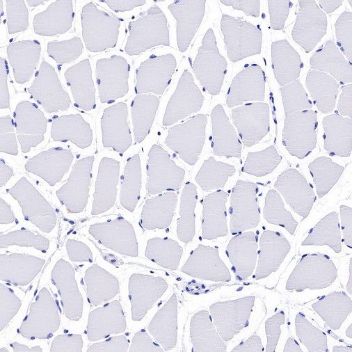 C1q Recombinant Rat mAb (S-R189)